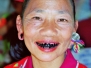 noord thailand